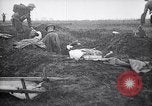 Image blessés les troupes américaines Valsery Couveres-et-France, 1918, de la seconde 22 séquences d'archives historiques vidéo 65675029584