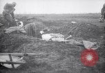 Image blessés les troupes américaines Valsery Couveres-et-France, 1918, de la seconde 23 séquences d'archives historiques vidéo 65675029584