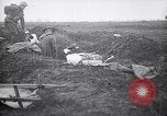 Image blessés les troupes américaines Valsery Couveres-et-France, 1918, de la seconde 24 séquences d'archives historiques vidéo 65675029584