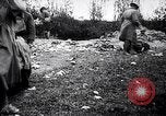 Image blessés les troupes américaines Valsery Couveres-et-France, 1918, de la seconde 36 séquences d'archives historiques vidéo 65675029584