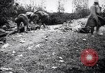 Image blessés les troupes américaines Valsery Couveres-et-France, 1918, de la seconde 50 séquences d'archives historiques vidéo 65675029584