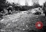 Image blessés les troupes américaines Valsery Couveres-et-France, 1918, de la seconde 51 séquences d'archives historiques vidéo 65675029584