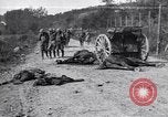Image blessés les soldats de l'Armée américaine France, 1918, de la seconde 1 séquences d'archives historiques vidéo 65675030274