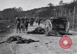 Image blessés les soldats de l'Armée américaine France, 1918, de la seconde 3 séquences d'archives historiques vidéo 65675030274