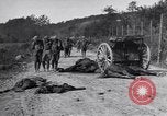 Image blessés les soldats de l'Armée américaine France, 1918, de la seconde 4 séquences d'archives historiques vidéo 65675030274