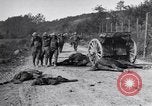 Image blessés les soldats de l'Armée américaine France, 1918, de la seconde 5 séquences d'archives historiques vidéo 65675030274