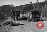 Image blessés les soldats de l'Armée américaine France, 1918, de la seconde 6 séquences d'archives historiques vidéo 65675030274