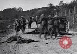 Image blessés les soldats de l'Armée américaine France, 1918, de la seconde 10 séquences d'archives historiques vidéo 65675030274