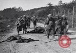 Image blessés les soldats de l'Armée américaine France, 1918, de la seconde 11 séquences d'archives historiques vidéo 65675030274