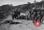 Image blessés les soldats de l'Armée américaine France, 1918, de la seconde 12 séquences d'archives historiques vidéo 65675030274