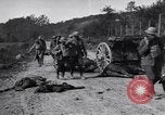 Image blessés les soldats de l'Armée américaine France, 1918, de la seconde 13 séquences d'archives historiques vidéo 65675030274