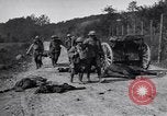 Image blessés les soldats de l'Armée américaine France, 1918, de la seconde 14 séquences d'archives historiques vidéo 65675030274