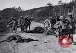 Image blessés les soldats de l'Armée américaine France, 1918, de la seconde 17 séquences d'archives historiques vidéo 65675030274