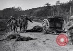 Image blessés les soldats de l'Armée américaine France, 1918, de la seconde 18 séquences d'archives historiques vidéo 65675030274