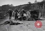 Image blessés les soldats de l'Armée américaine France, 1918, de la seconde 20 séquences d'archives historiques vidéo 65675030274