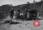 Image blessés les soldats de l'Armée américaine France, 1918, de la seconde 21 séquences d'archives historiques vidéo 65675030274