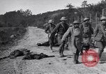 Image blessés les soldats de l'Armée américaine France, 1918, de la seconde 25 séquences d'archives historiques vidéo 65675030274
