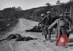 Image blessés les soldats de l'Armée américaine France, 1918, de la seconde 26 séquences d'archives historiques vidéo 65675030274