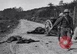 Image blessés les soldats de l'Armée américaine France, 1918, de la seconde 28 séquences d'archives historiques vidéo 65675030274