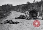 Image blessés les soldats de l'Armée américaine France, 1918, de la seconde 30 séquences d'archives historiques vidéo 65675030274