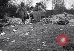 Image blessés les soldats de l'Armée américaine France, 1918, de la seconde 31 séquences d'archives historiques vidéo 65675030274