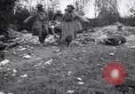 Image blessés les soldats de l'Armée américaine France, 1918, de la seconde 32 séquences d'archives historiques vidéo 65675030274