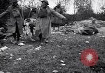 Image blessés les soldats de l'Armée américaine France, 1918, de la seconde 36 séquences d'archives historiques vidéo 65675030274