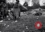 Image blessés les soldats de l'Armée américaine France, 1918, de la seconde 37 séquences d'archives historiques vidéo 65675030274