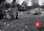 Image blessés les soldats de l'Armée américaine France, 1918, de la seconde 38 séquences d'archives historiques vidéo 65675030274
