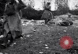 Image blessés les soldats de l'Armée américaine France, 1918, de la seconde 40 séquences d'archives historiques vidéo 65675030274
