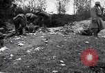 Image blessés les soldats de l'Armée américaine France, 1918, de la seconde 55 séquences d'archives historiques vidéo 65675030274