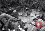 Image blessés les soldats de l'Armée américaine France, 1918, de la seconde 58 séquences d'archives historiques vidéo 65675030274