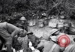 Image blessés les soldats de l'Armée américaine France, 1918, de la seconde 59 séquences d'archives historiques vidéo 65675030274