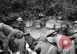 Image blessés les soldats de l'Armée américaine France, 1918, de la seconde 60 séquences d'archives historiques vidéo 65675030274