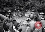 Image blessés les soldats de l'Armée américaine France, 1918, de la seconde 61 séquences d'archives historiques vidéo 65675030274