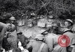Image blessés les soldats de l'Armée américaine France, 1918, de la seconde 62 séquences d'archives historiques vidéo 65675030274