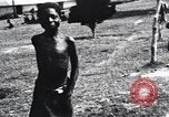Image of sleeping sickness Congo, 1940, second 37 stock footage video 65675032243
