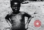 Image of sleeping sickness Congo, 1940, second 42 stock footage video 65675032243