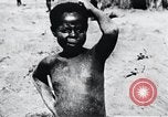 Image of sleeping sickness Congo, 1940, second 44 stock footage video 65675032243