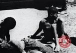 Image of sleeping sickness Congo, 1940, second 14 stock footage video 65675032245