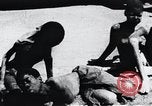 Image of sleeping sickness Congo, 1940, second 18 stock footage video 65675032245