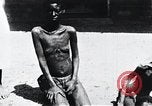 Image of sleeping sickness Congo, 1940, second 21 stock footage video 65675032245
