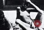 Image of sleeping sickness Congo, 1940, second 30 stock footage video 65675032245