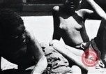 Image of sleeping sickness Congo, 1940, second 31 stock footage video 65675032245