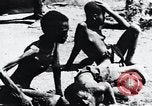 Image of sleeping sickness Congo, 1940, second 36 stock footage video 65675032245