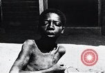 Image of sleeping sickness Congo, 1940, second 46 stock footage video 65675032245