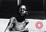 Image of sleeping sickness Congo, 1940, second 47 stock footage video 65675032245
