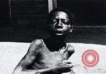 Image of sleeping sickness Congo, 1940, second 48 stock footage video 65675032245