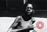 Image of sleeping sickness Congo, 1940, second 49 stock footage video 65675032245