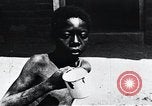 Image of sleeping sickness Congo, 1940, second 51 stock footage video 65675032245